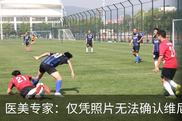 医美专家：仅凭照片无法确认维尼修斯做过哪些医美项目